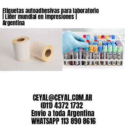 Etiquetas autoadhesivas para laboratorio | Líder mundial en impresiones | Argentina
